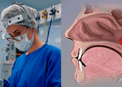 Otorrino em Brusque, cirurgia de adenoide em crianças, quando é necessária - dra mariana nunes