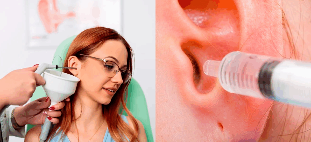 limpeza de ouvido - otorrino em brusque - consulta médica - dra. mariana nunes