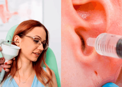 limpeza de ouvido - otorrino em brusque - consulta médica - dra. mariana nunes