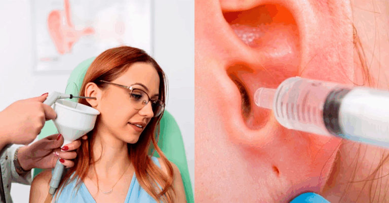 Como Funciona a Limpeza de Ouvido e Quando Fazer com o Otorrino em Brusque